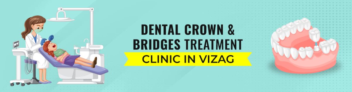 dental crown or bridge treatment in Vizag