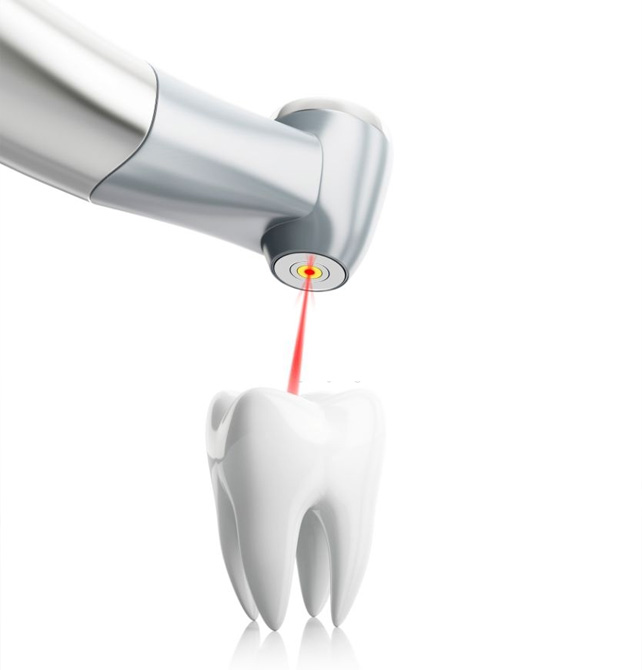 Root Canal Treatment in Visakhapatnam