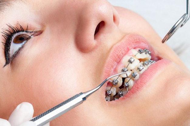 Best Orthodontic Treatment in Vizag