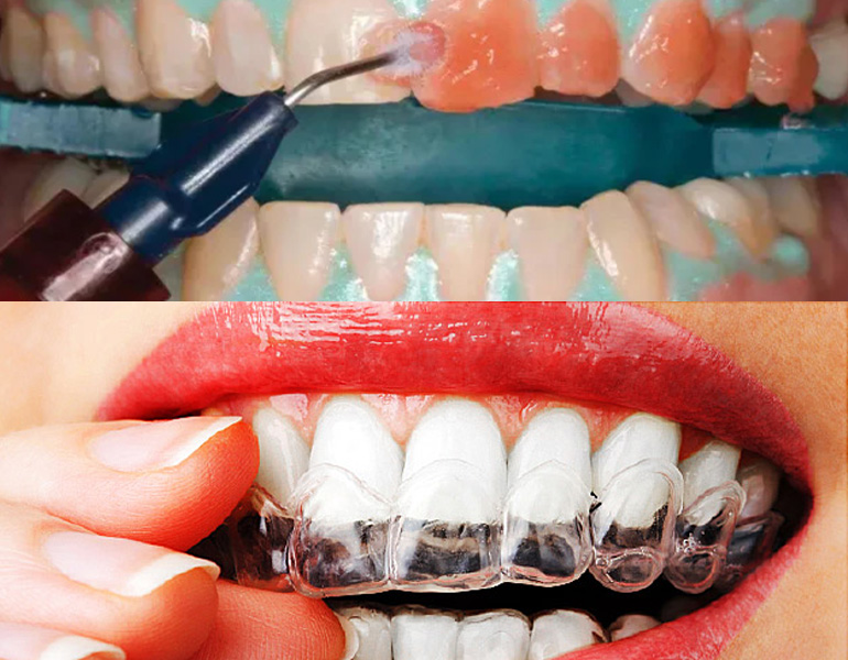 Cosmetic Dental Clinic in Visakhapatnam